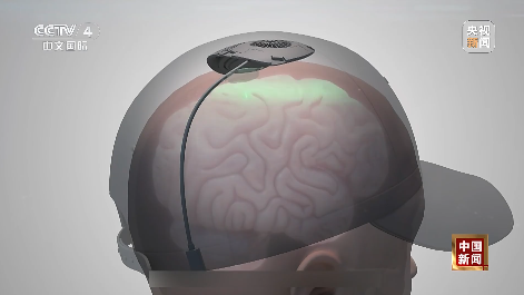 我国科学家在世界上首次绘制！事关脑科学